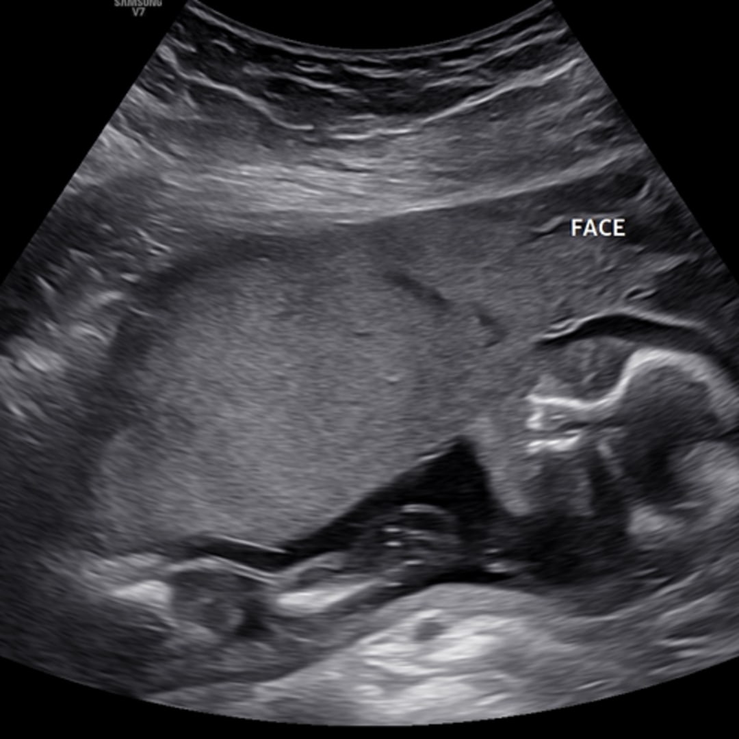 Photo shared by Allison for their Babylist baby registry.