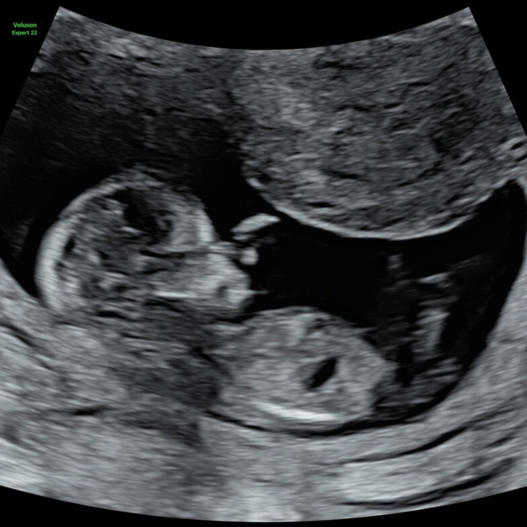 Photo shared by Chantal for their Babylist baby registry.