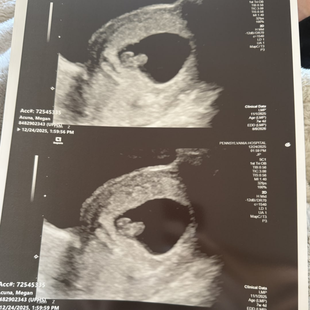 Photo shared by Megan for their Babylist baby registry.