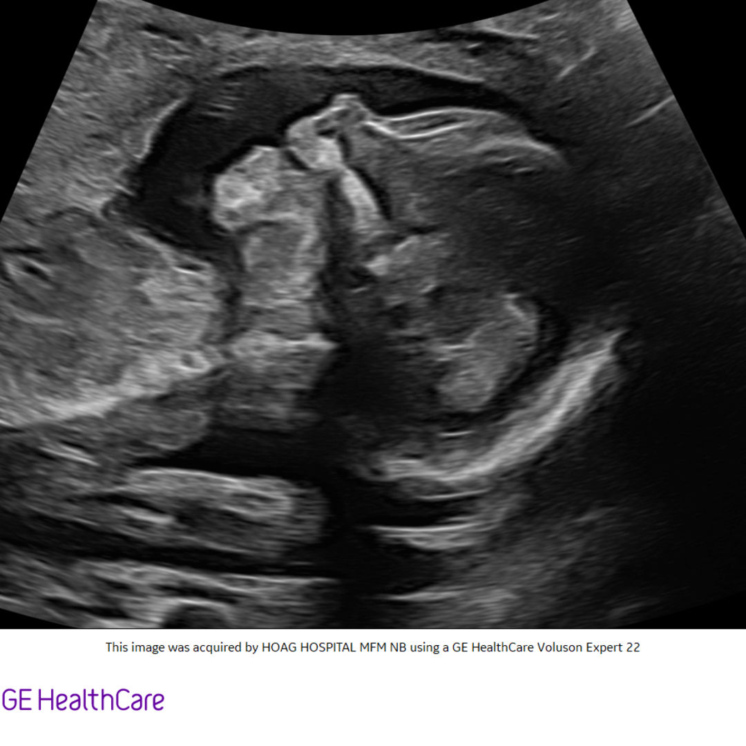 Photo shared by Crystal for their Babylist baby registry.