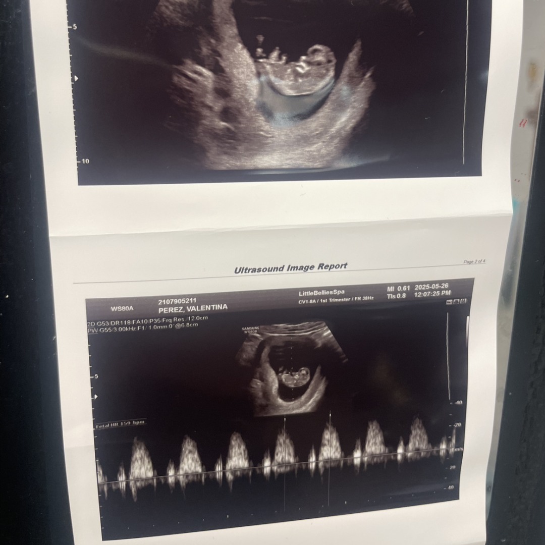 Photo shared by Valentina for their Babylist baby registry.