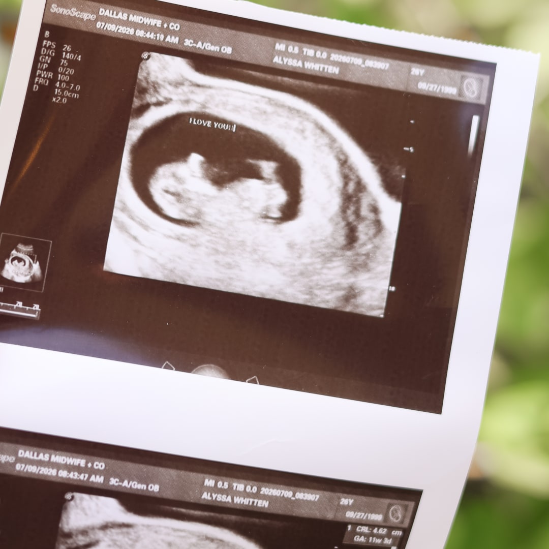 Photo shared by Alyssa for their Babylist baby registry.