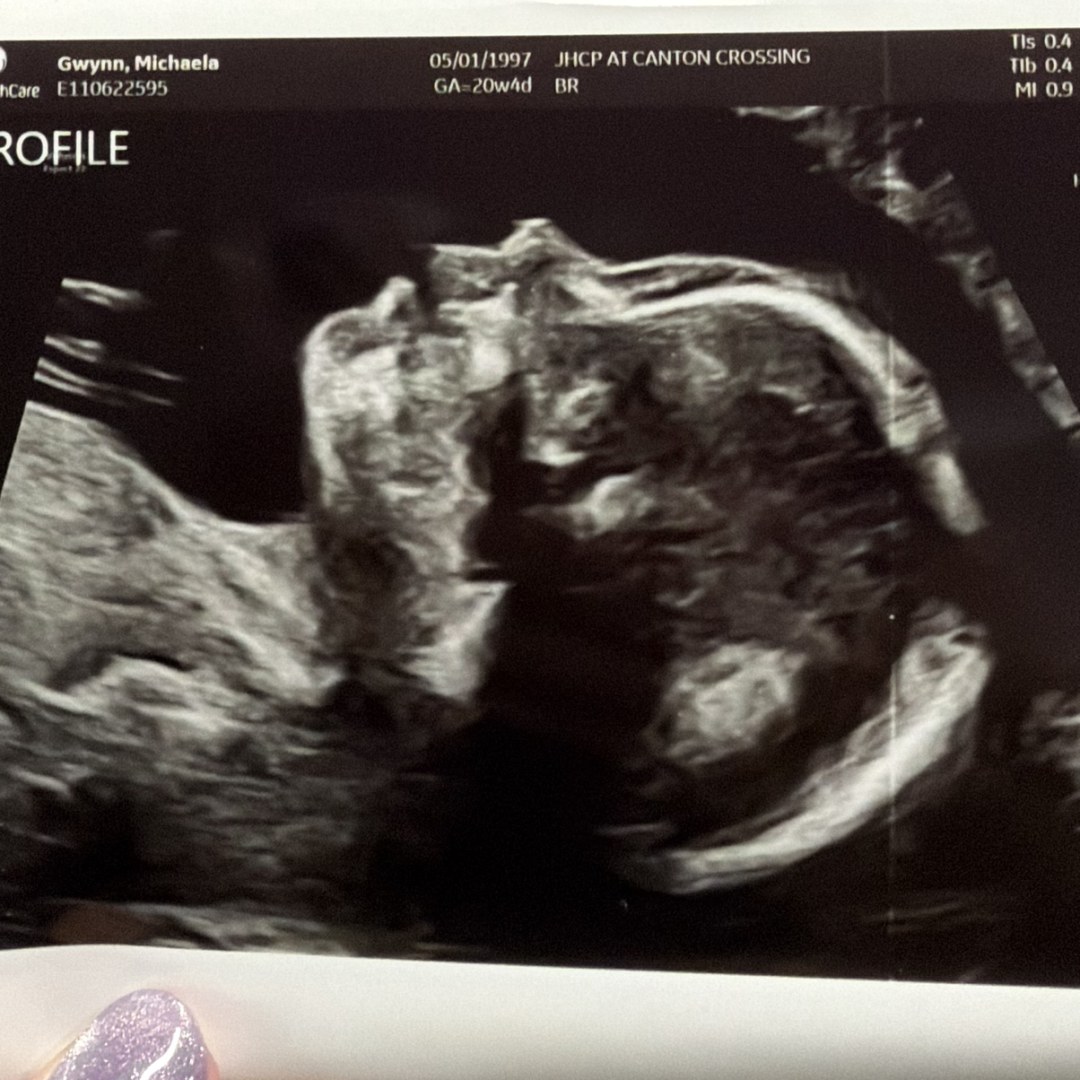 Photo shared by Michaela for their Babylist baby registry.