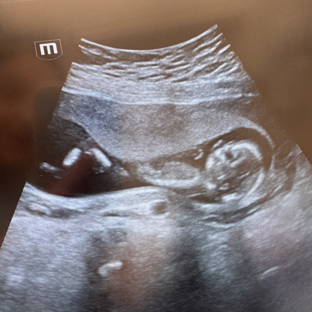 Photo shared by Baley for their Babylist baby registry.