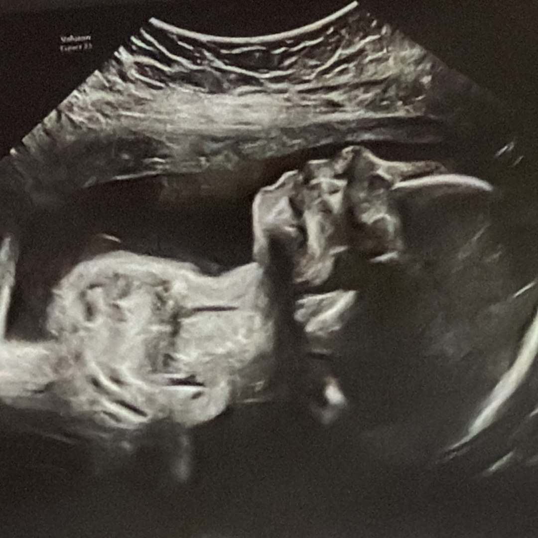 Photo shared by Emelin for their Babylist baby registry.