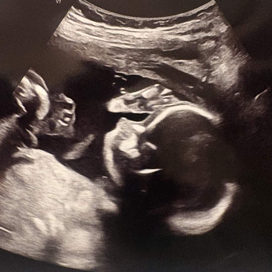 Photo shared by Machayla for their Babylist baby registry.