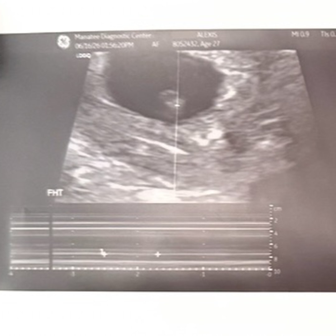 Photo shared by Alexis for their Babylist baby registry.