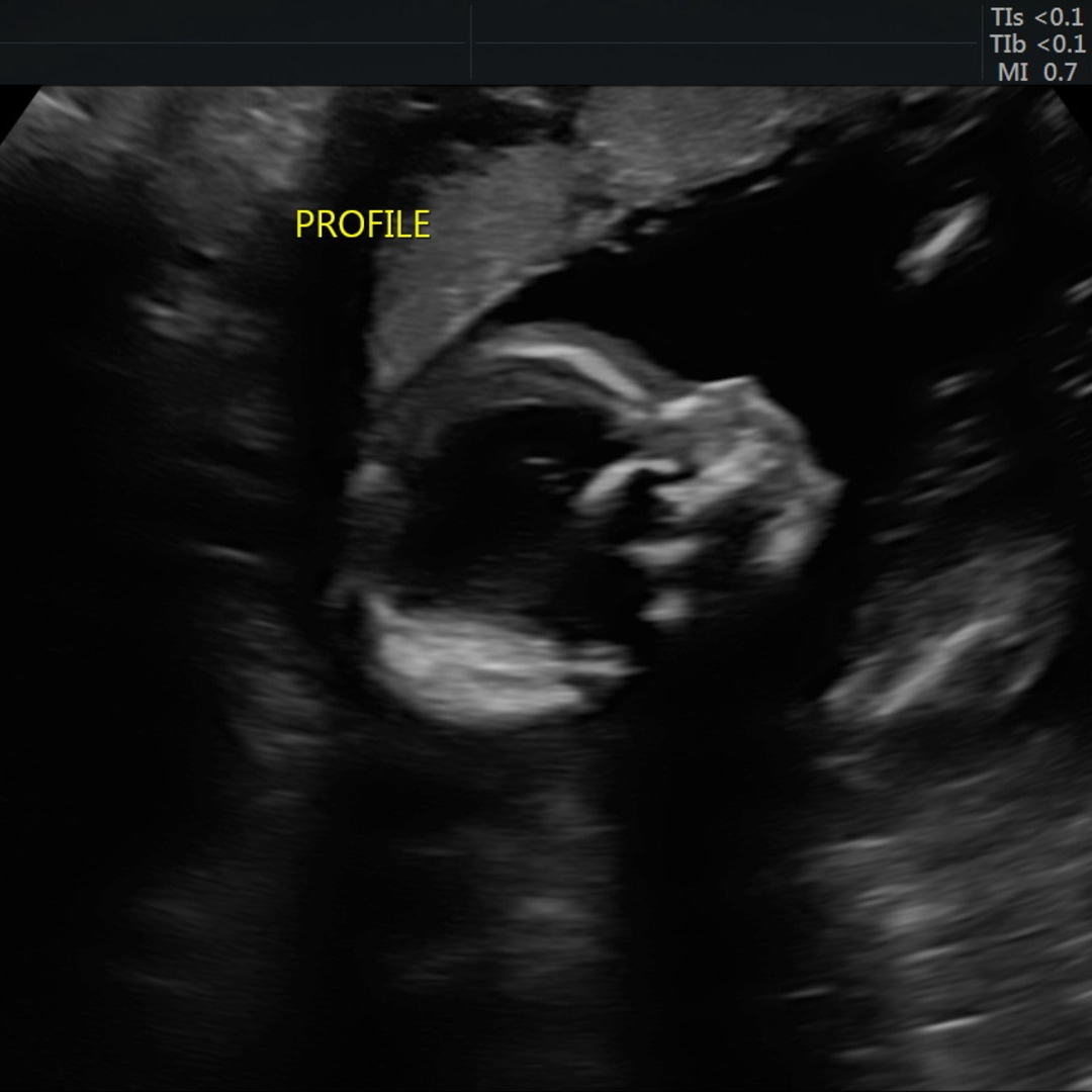 Photo shared by Brooke for their Babylist baby registry.