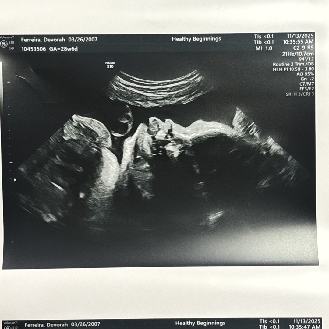 Photo shared by Devorah for their Babylist baby registry.