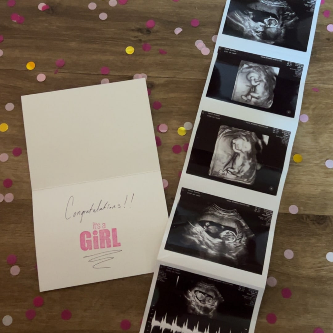 Photo shared by Brook for their Babylist baby registry.