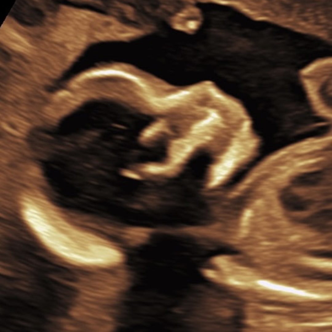 Photo shared by Holly for their Babylist baby registry.