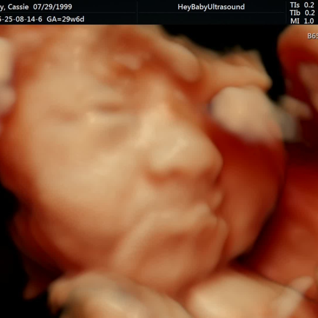 Photo shared by Cassandra for their Babylist baby registry.
