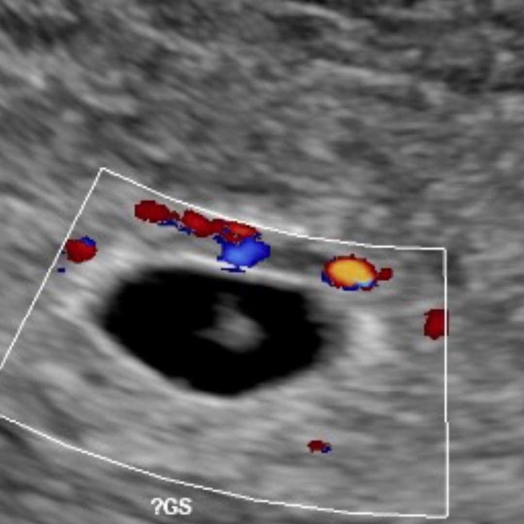 Photo shared by Carley for their Babylist baby registry.