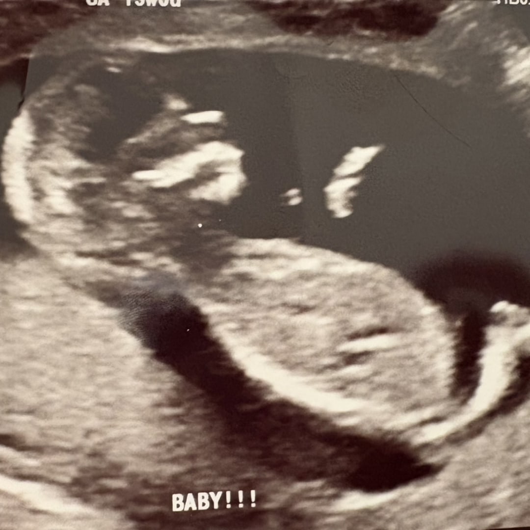 Photo shared by Yaniuska for their Babylist baby registry.