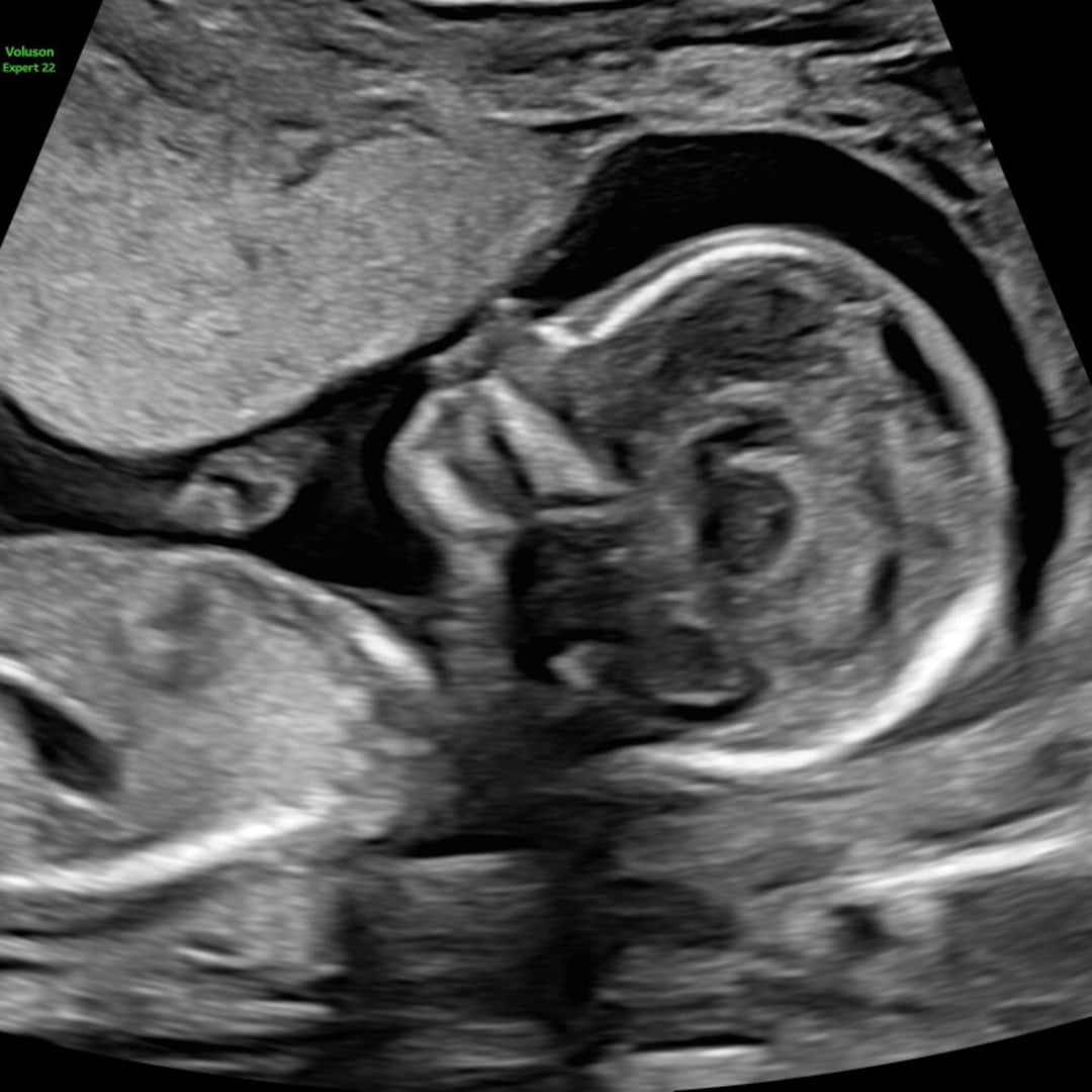 Photo shared by Cheyenne for their Babylist baby registry.