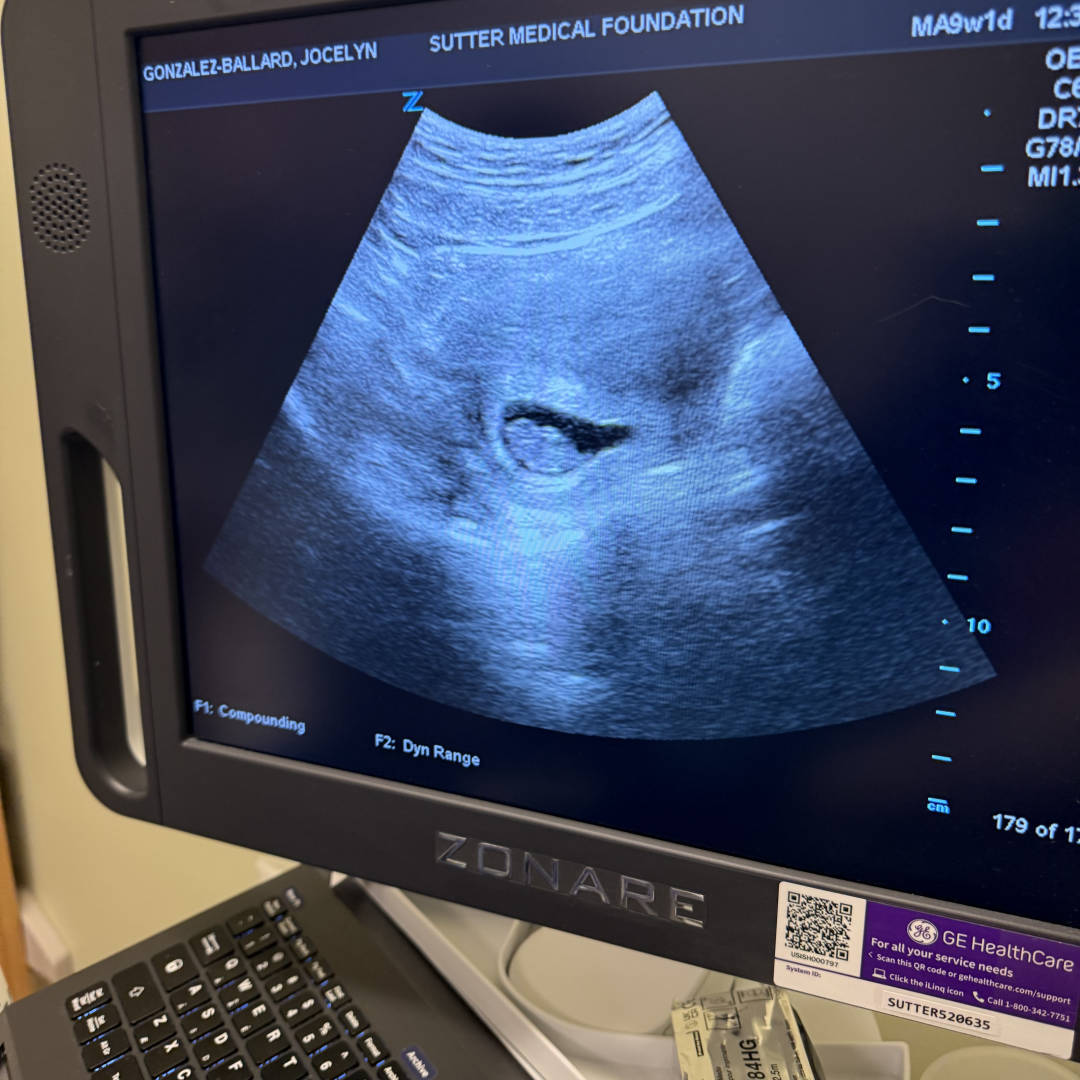 Photo shared by Jocelyn for their Babylist baby registry.