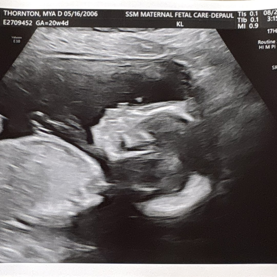Photo shared by Mya for their Babylist baby registry.