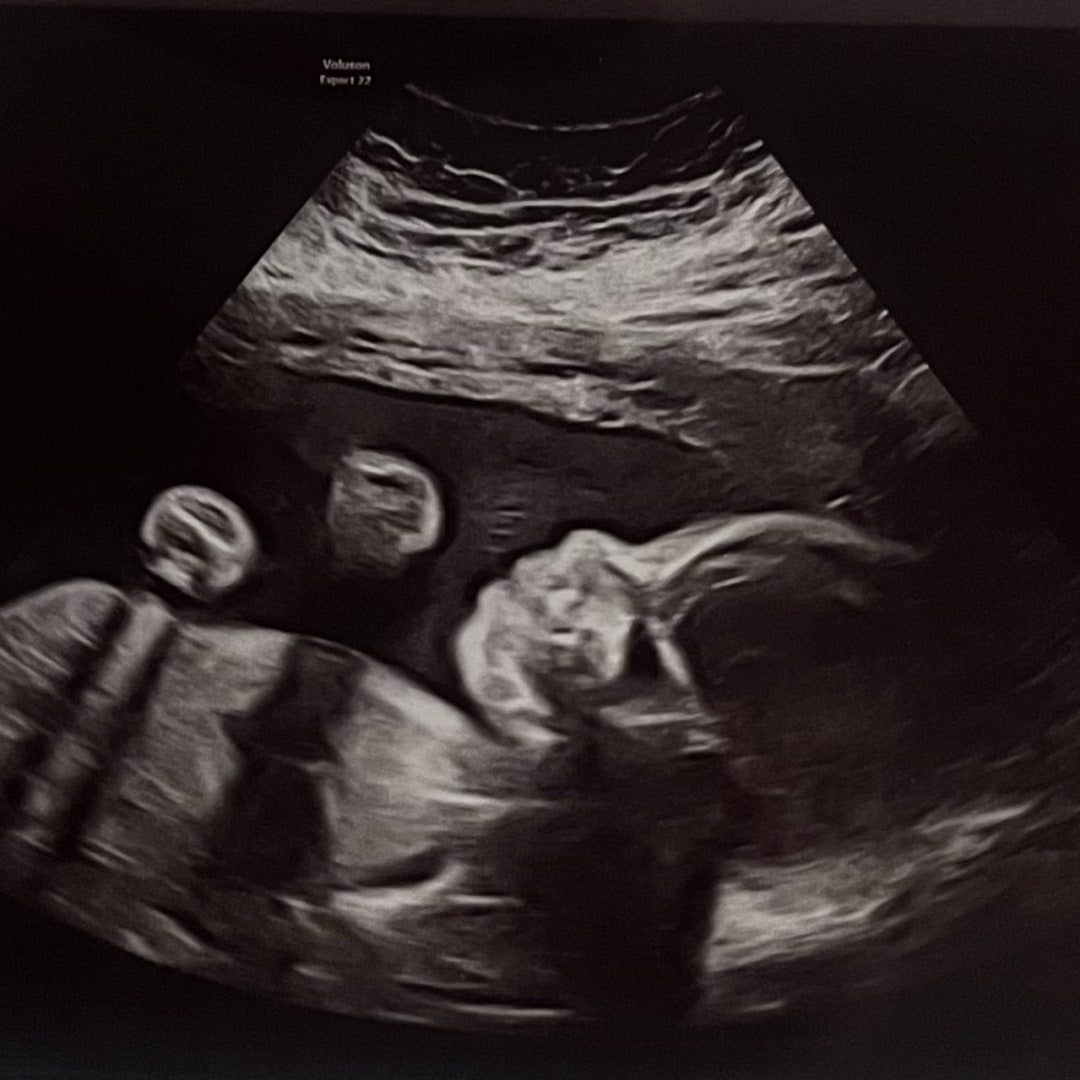 Photo shared by Gracie for their Babylist baby registry.