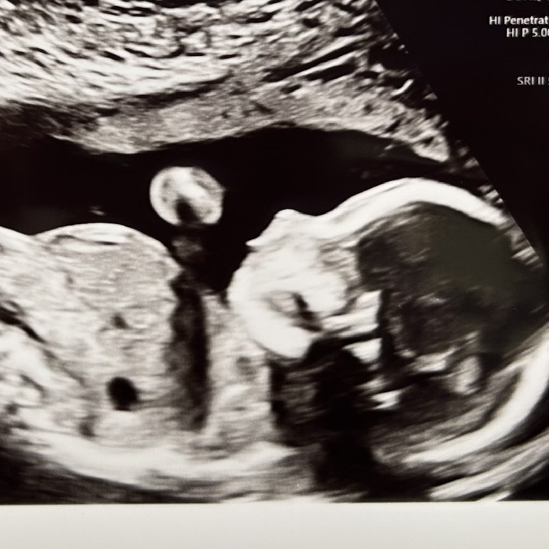 Photo shared by Jennifer for their Babylist baby registry.