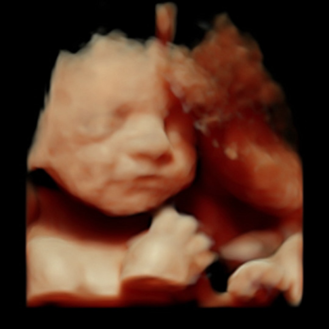 Photo shared by Bianca for their Babylist baby registry.