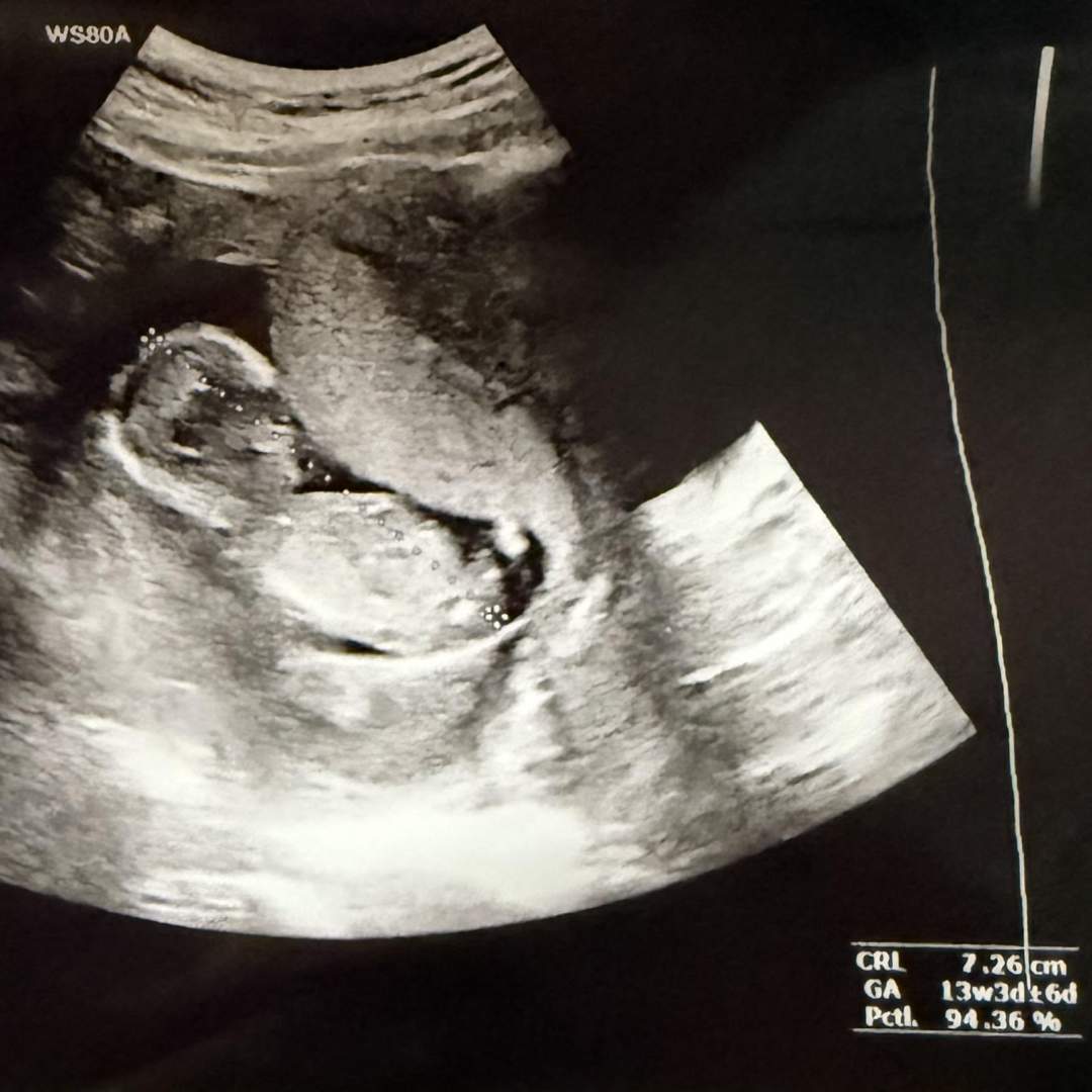 Photo shared by Brianna for their Babylist baby registry.