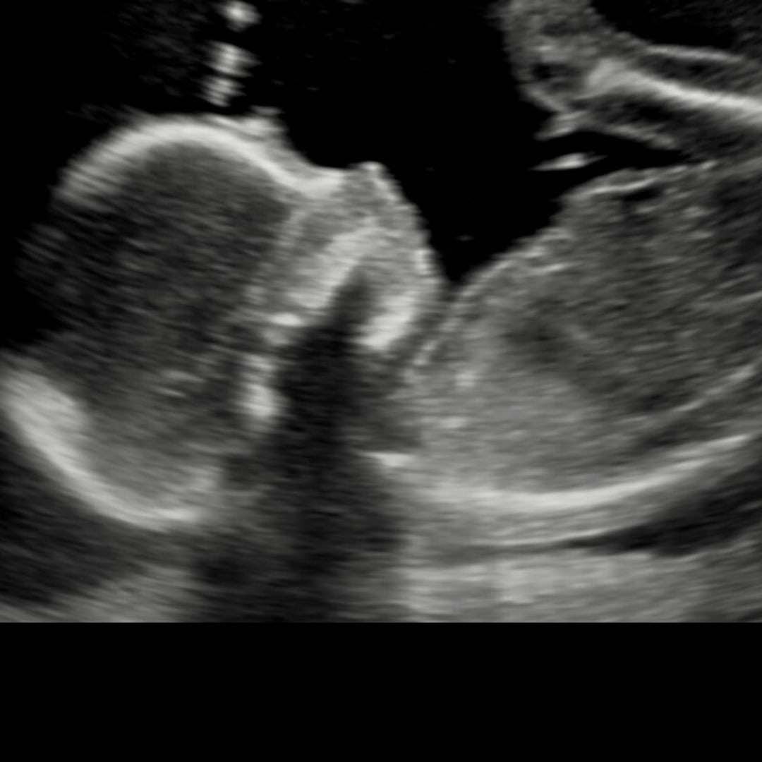 Photo shared by Sherri for their Babylist baby registry.