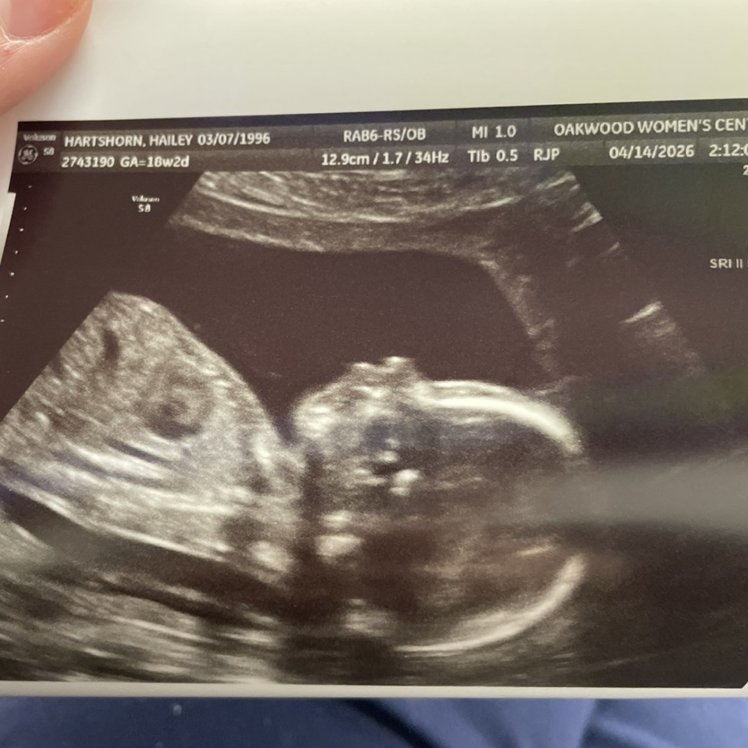 Photo shared by Hailey for their Babylist baby registry.
