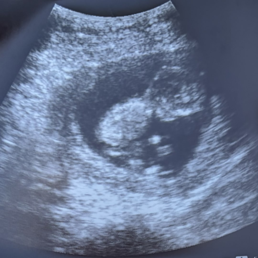 Photo shared by Jenny for their Babylist baby registry.