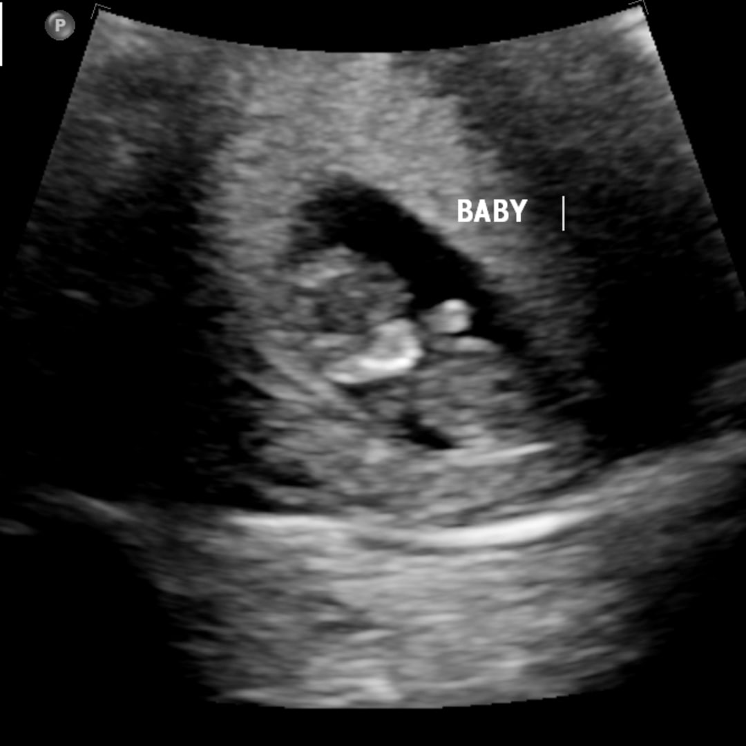 Photo shared by Candis for their Babylist baby registry.