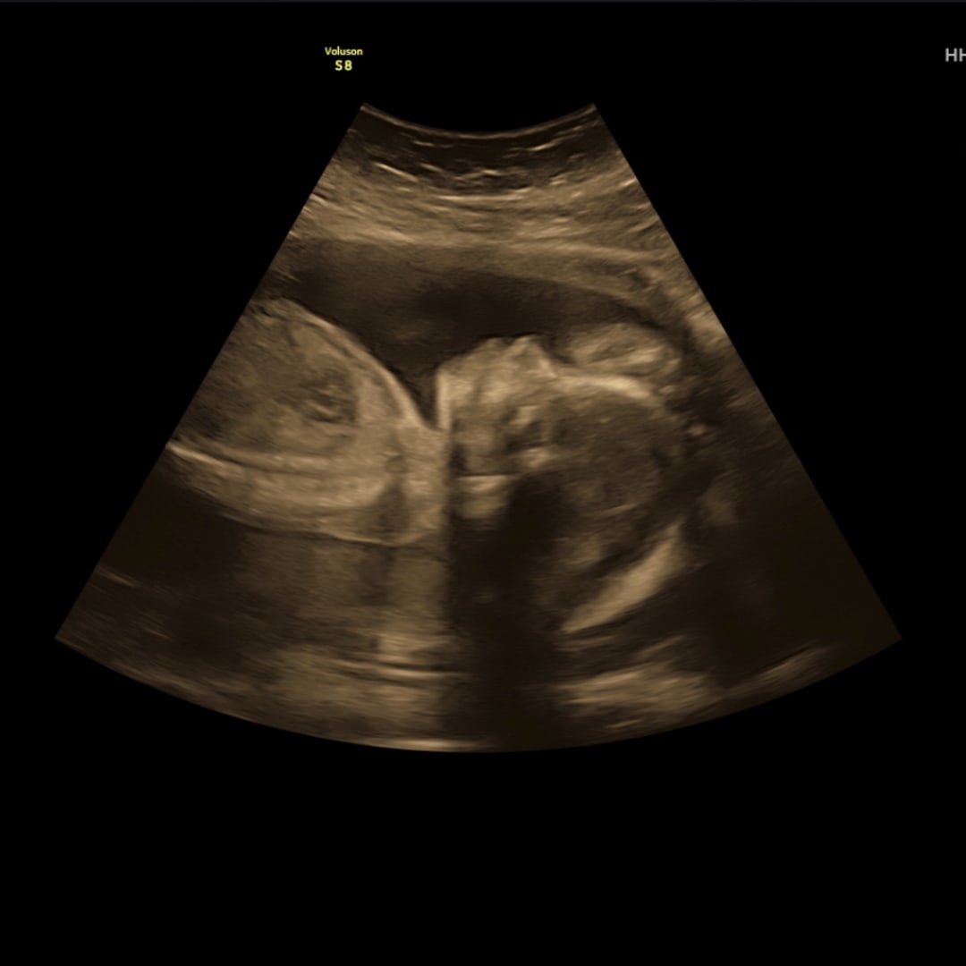 Photo shared by Anné for their Babylist baby registry.