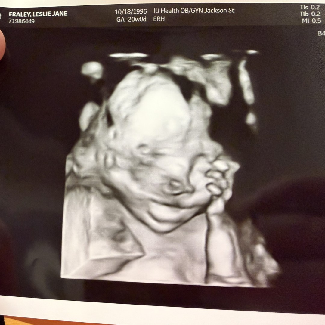 Photo shared by Leslie for their Babylist baby registry.