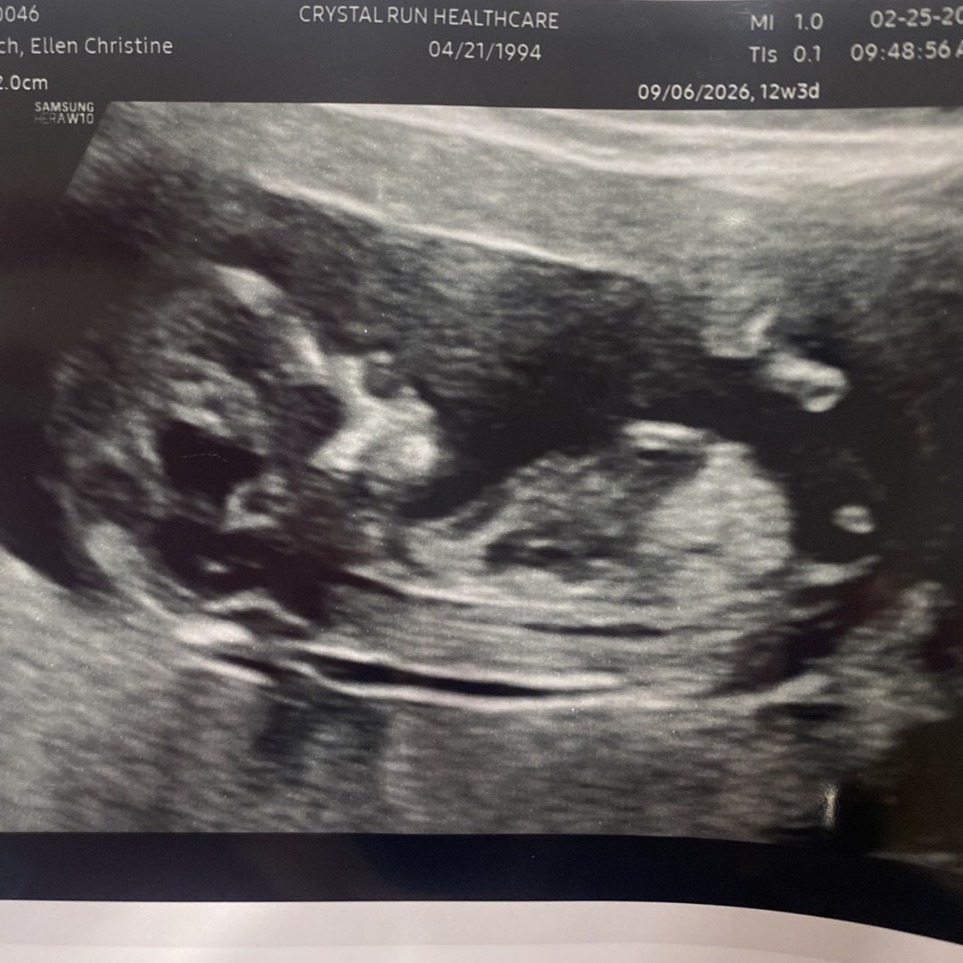 Photo shared by Ellen for their Babylist baby registry.