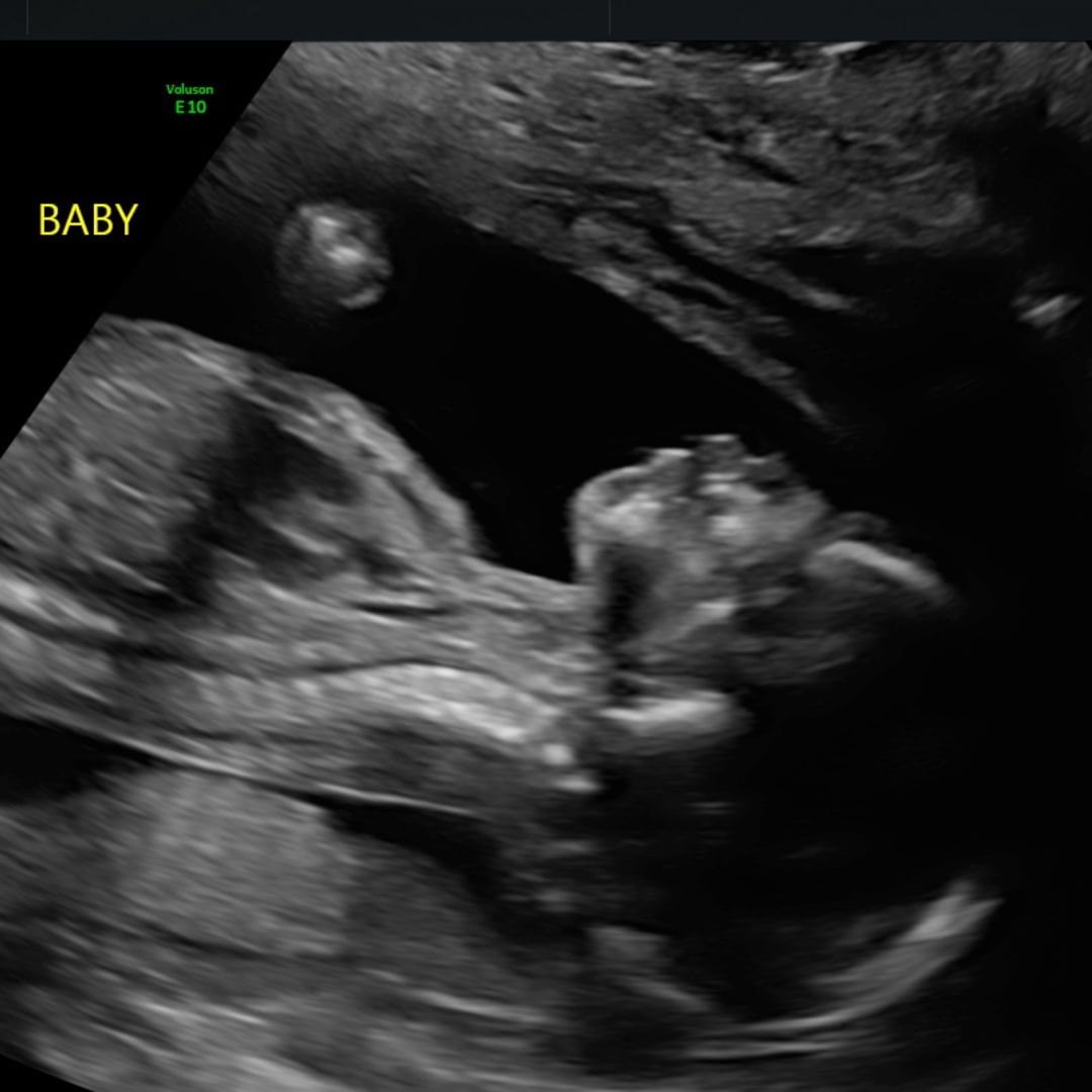 Photo shared by Barbara for their Babylist baby registry.