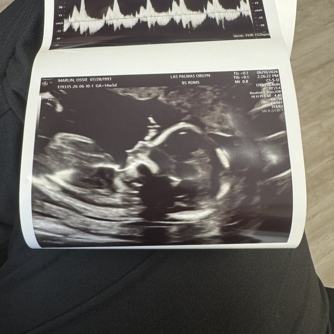 Photo shared by Ossie for their Babylist baby registry.