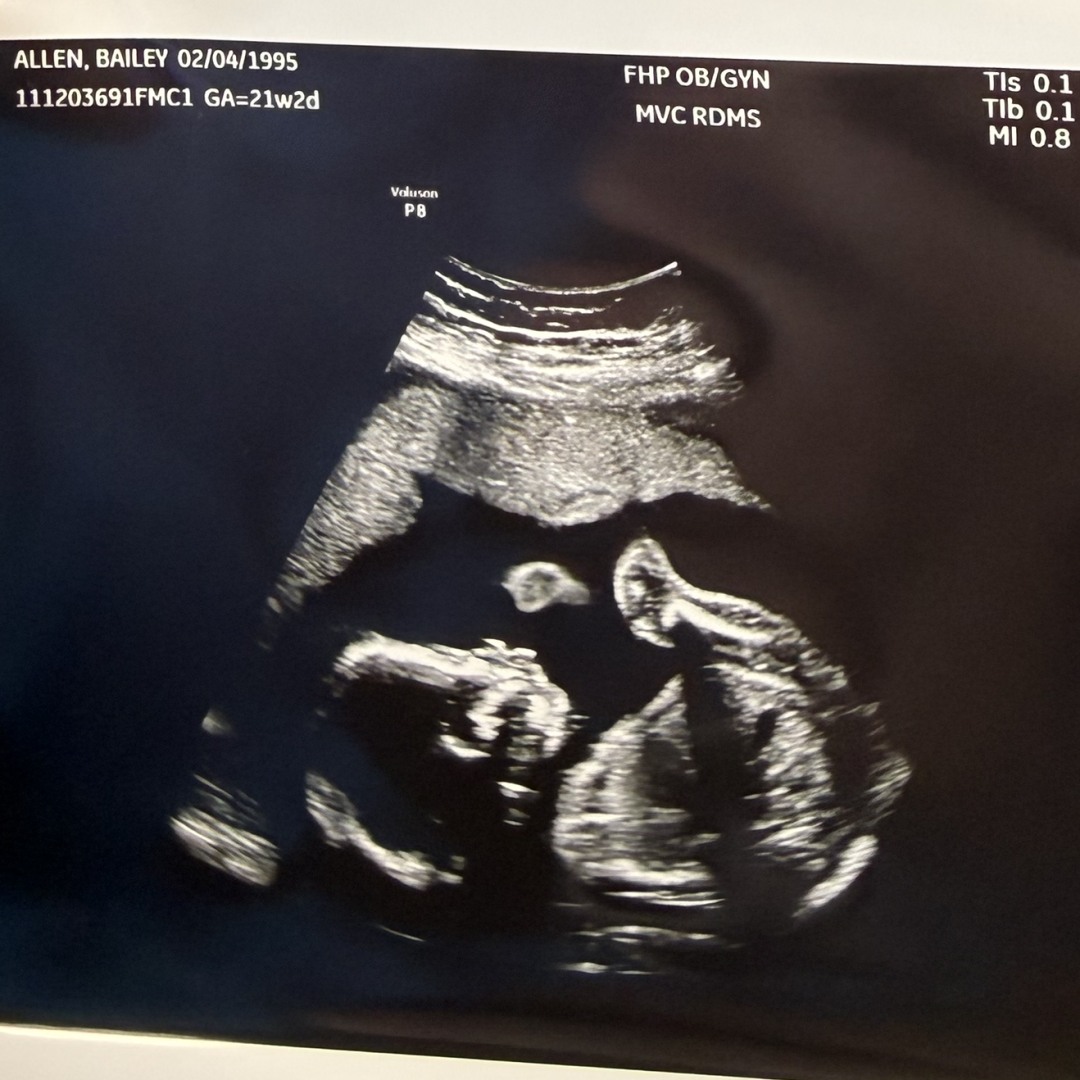 Photo shared by Bailey for their Babylist baby registry.