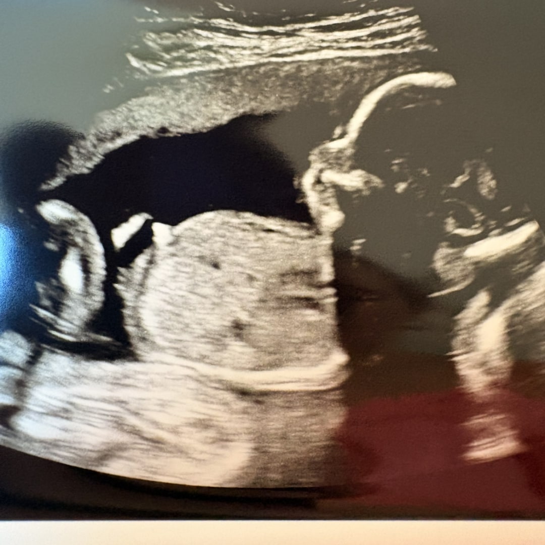 Photo shared by Amaretta for their Babylist baby registry.