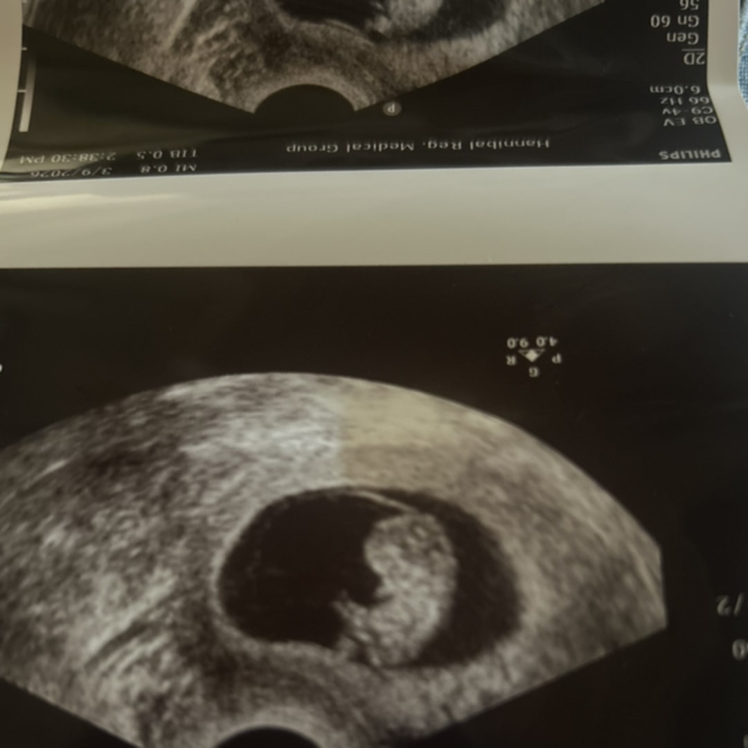 Photo shared by Lillian for their Babylist baby registry.