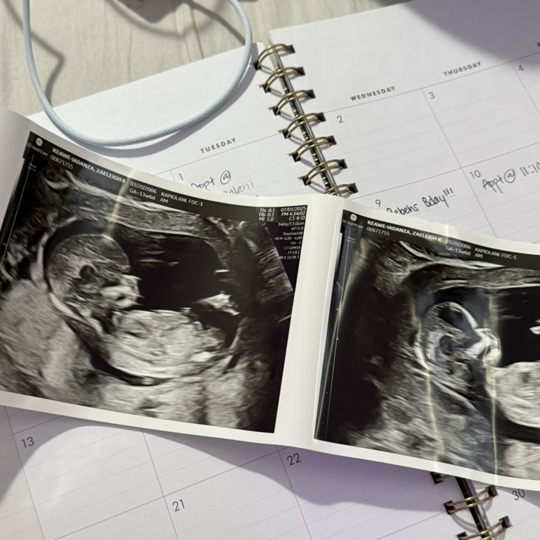 Photo shared by Zaeleigh for their Babylist baby registry.