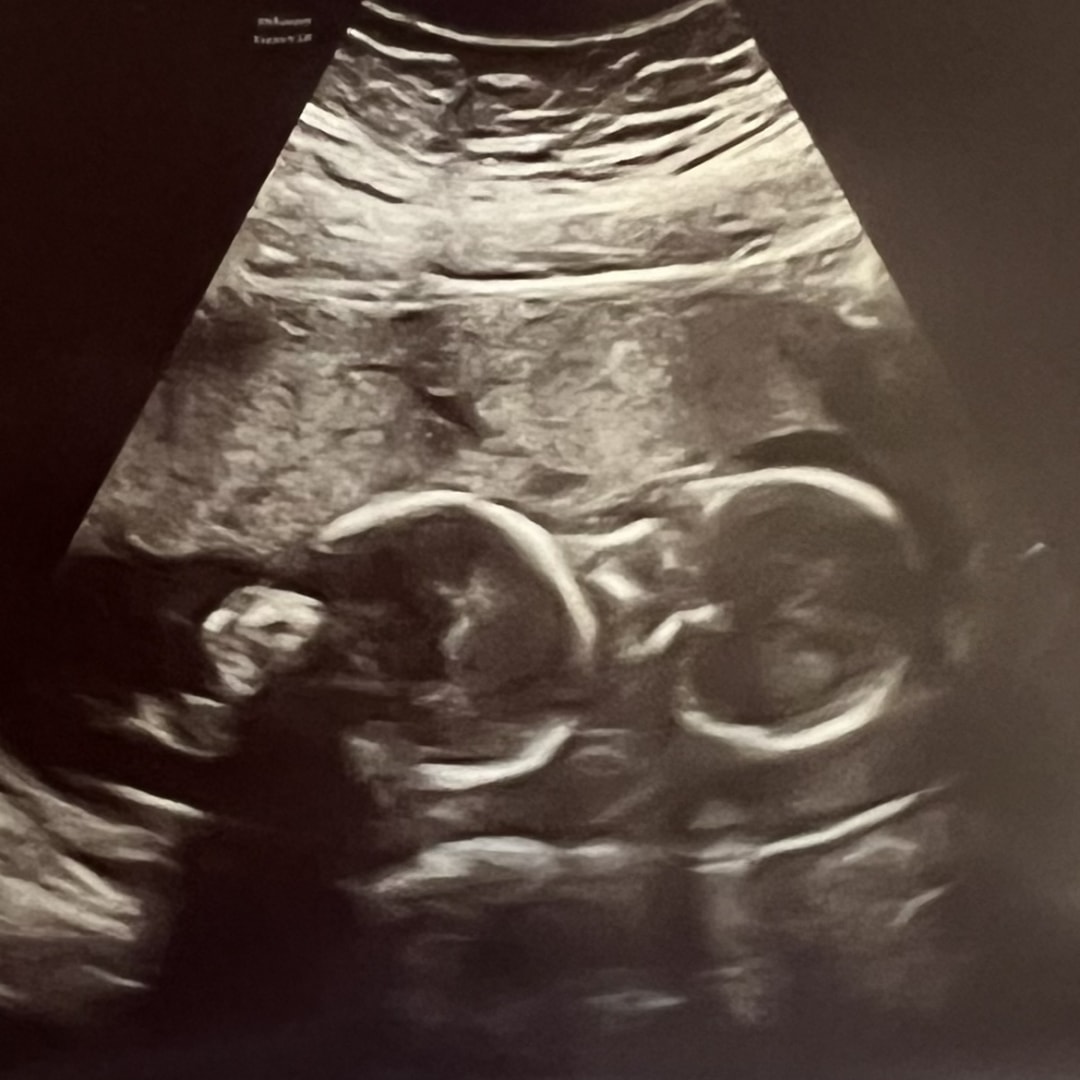 Photo shared by Emily for their Babylist baby registry.