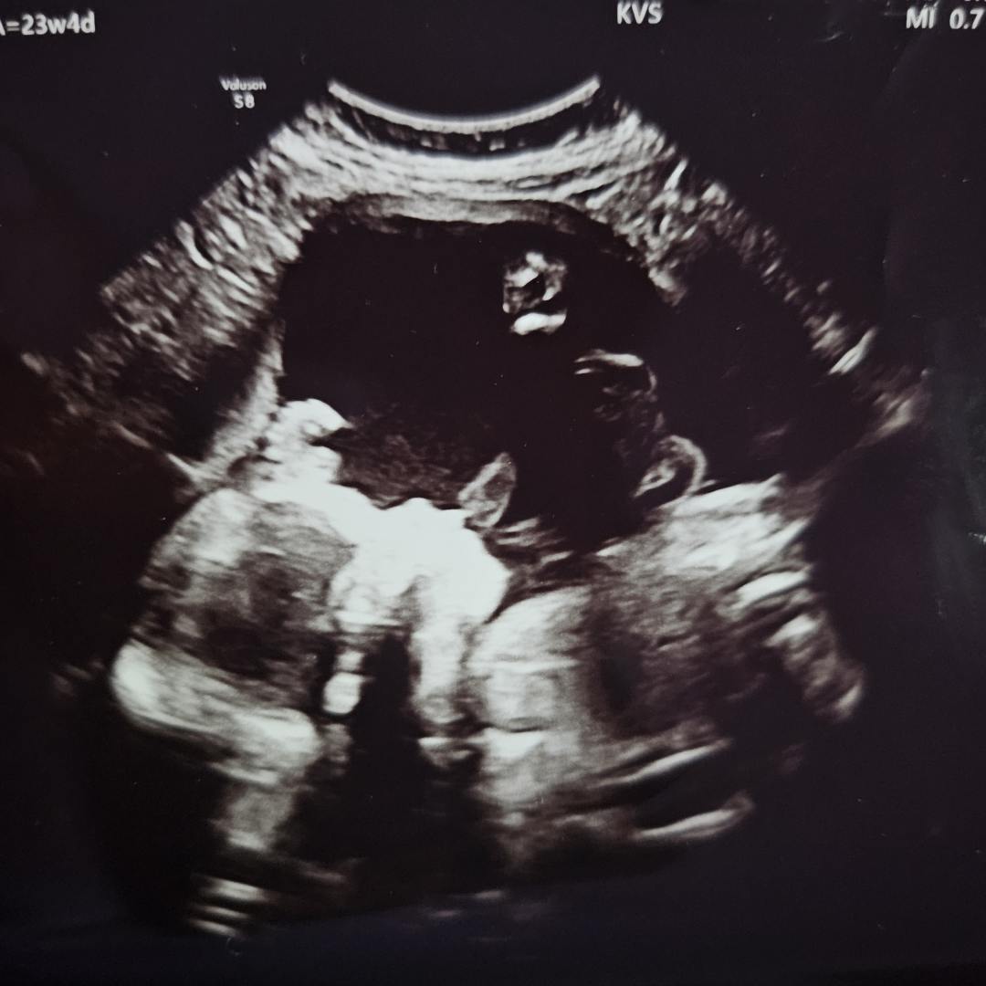 Photo shared by Kaya for their Babylist baby registry.