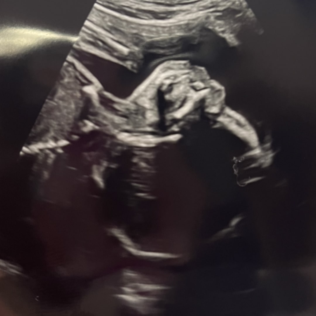 Photo shared by Kamari for their Babylist baby registry.