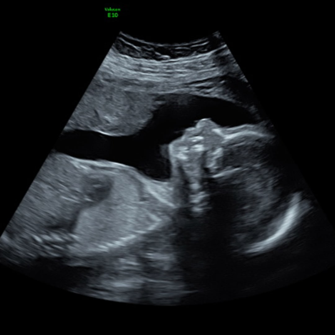 Photo shared by Viviana for their Babylist baby registry.