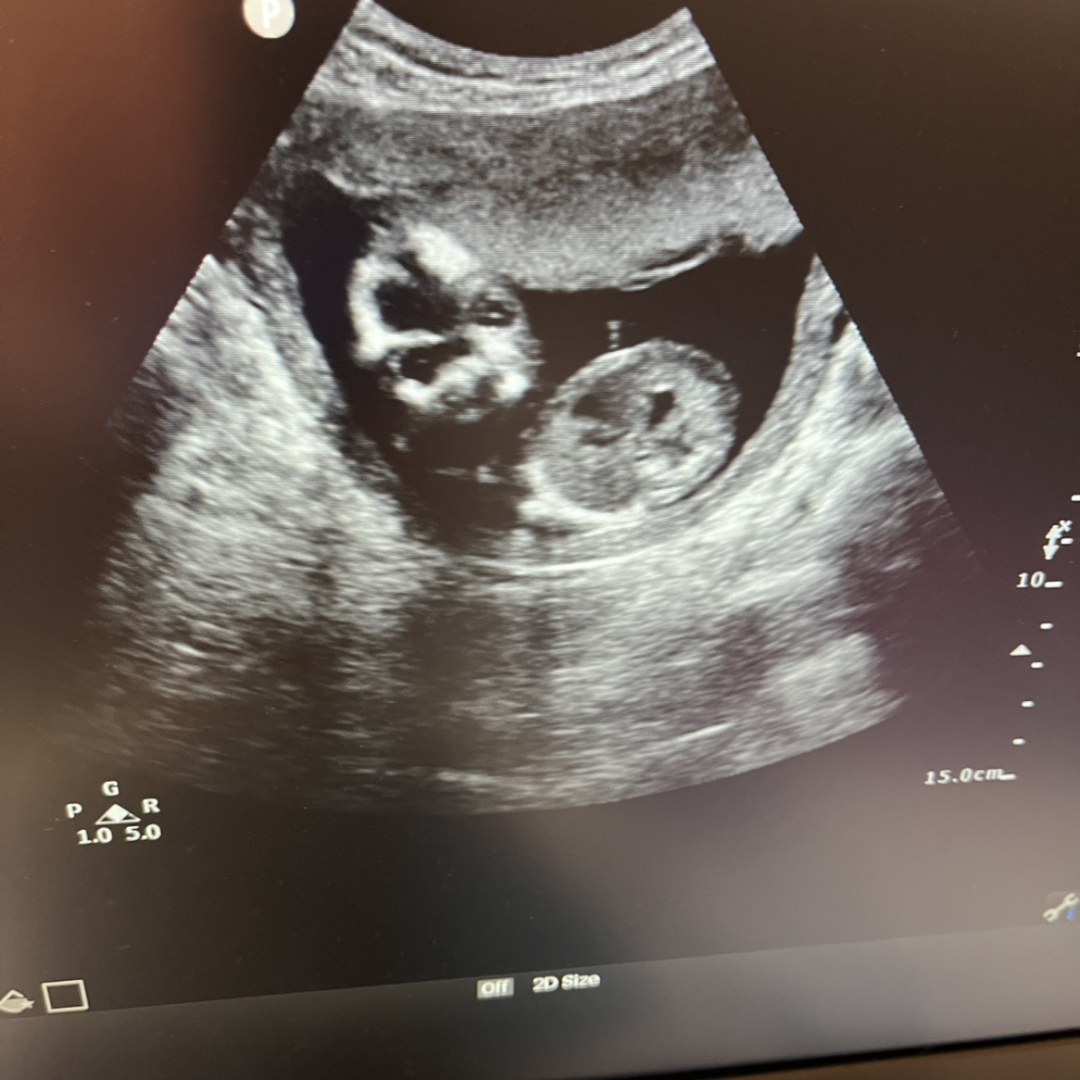 Photo shared by Rachel for their Babylist baby registry.