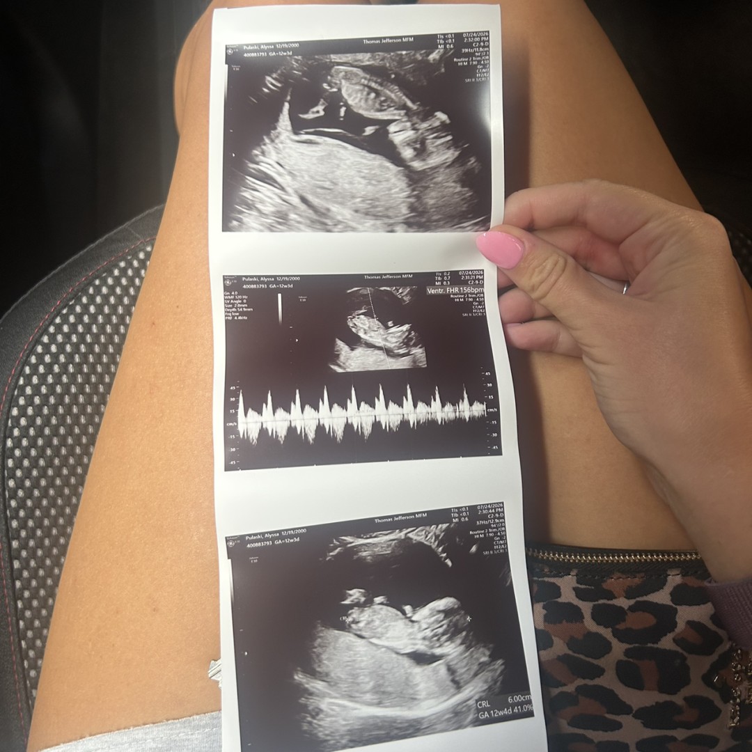 Photo shared by Alyssa for their Babylist baby registry.
