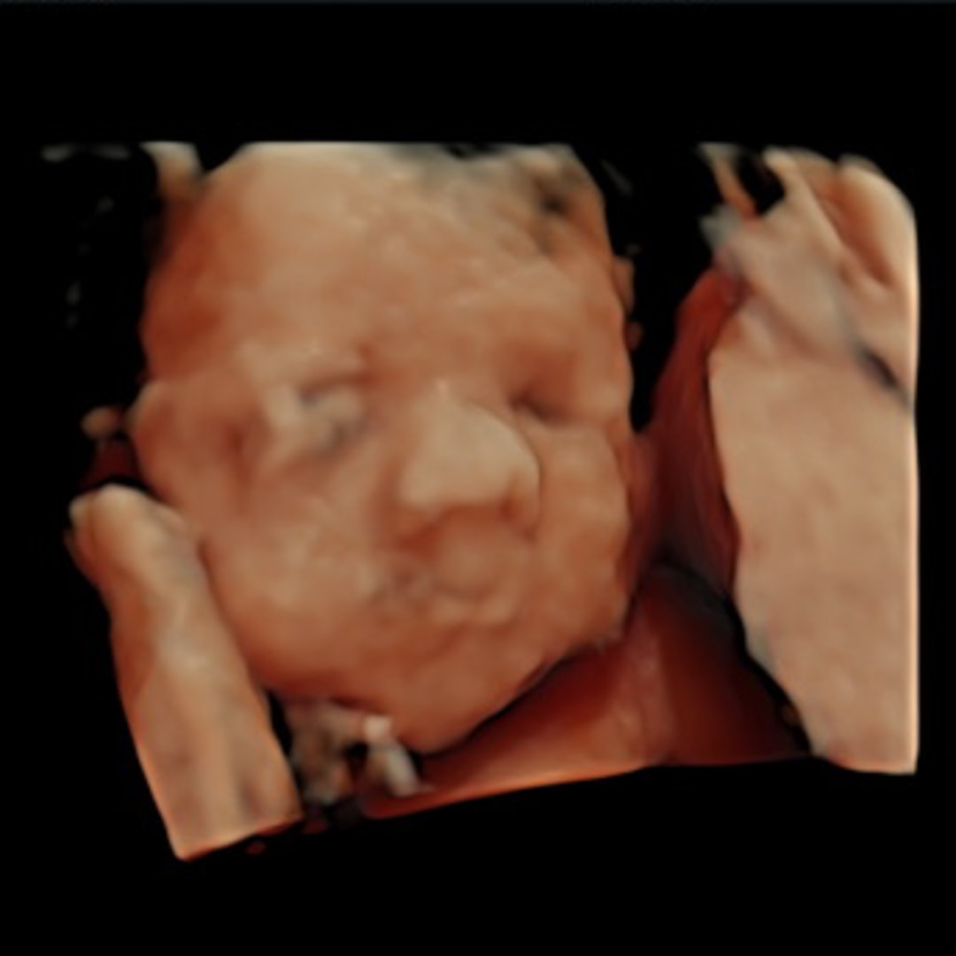 Photo shared by Madison for their Babylist baby registry.