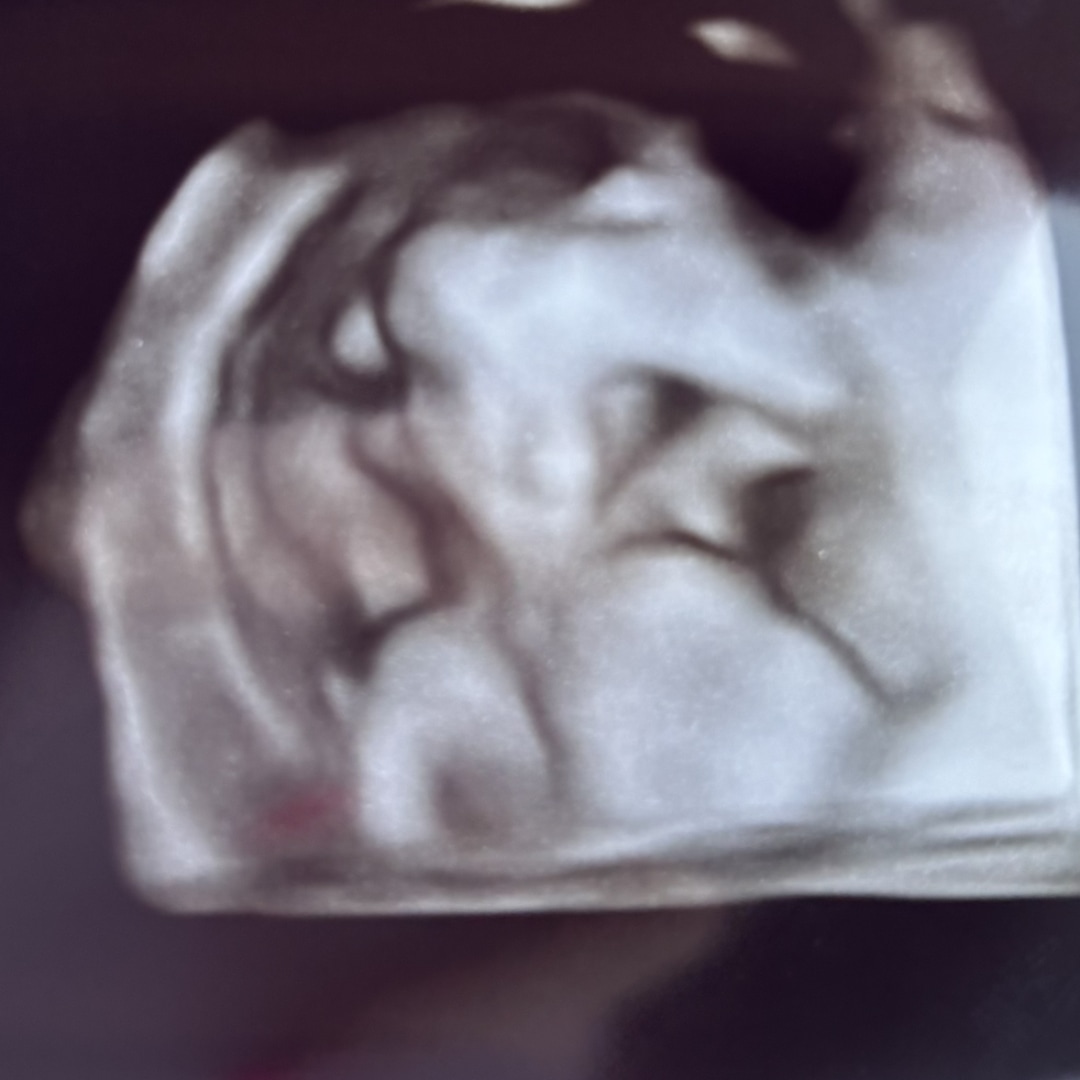 Photo shared by Kassidy for their Babylist baby registry.