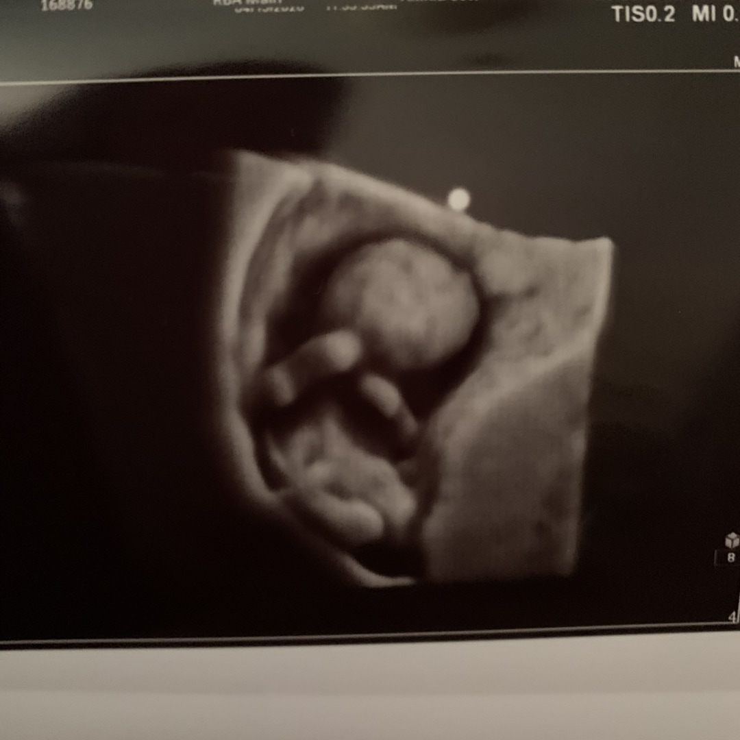 Photo shared by Sarah for their Babylist baby registry.