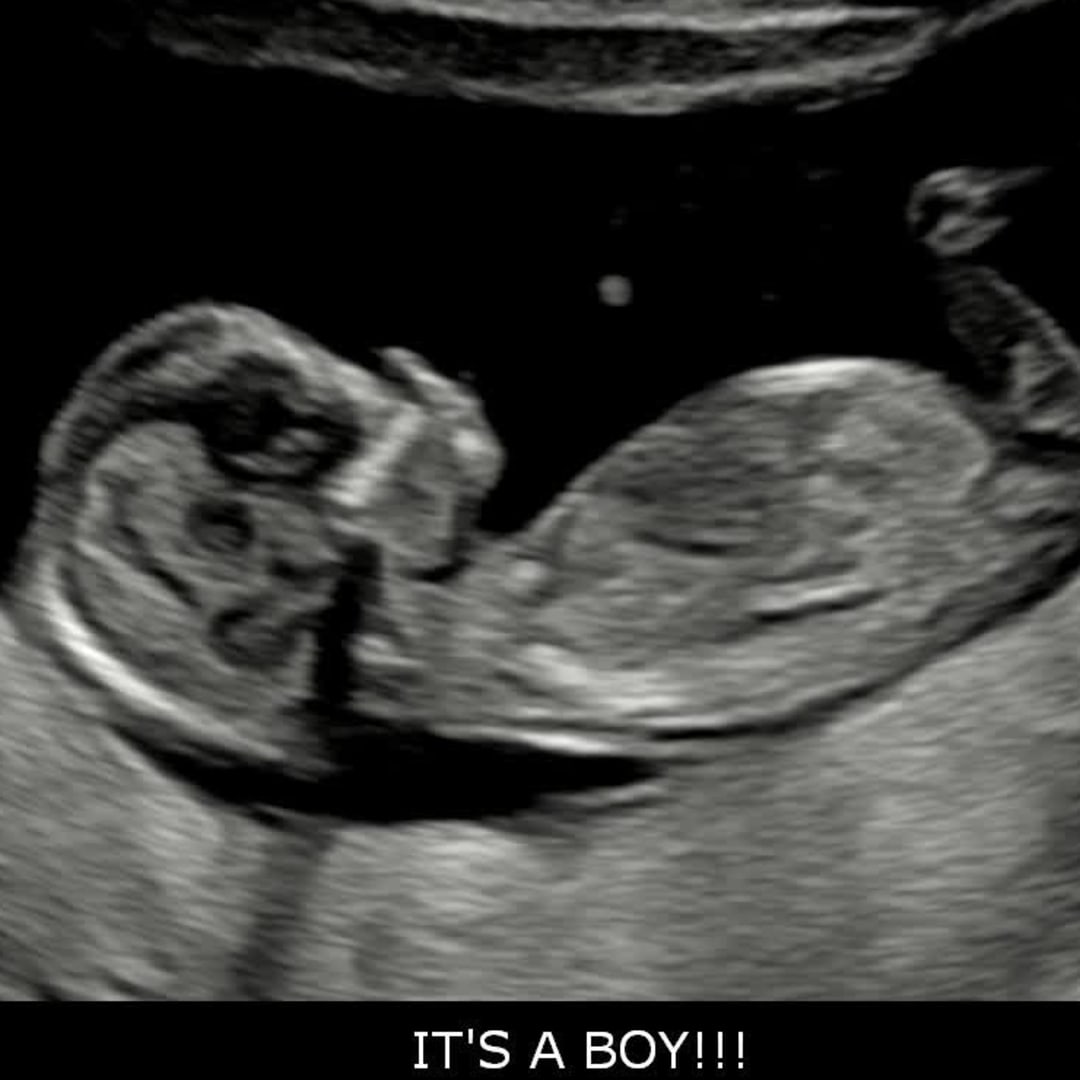 Photo shared by Madeleine for their Babylist baby registry.