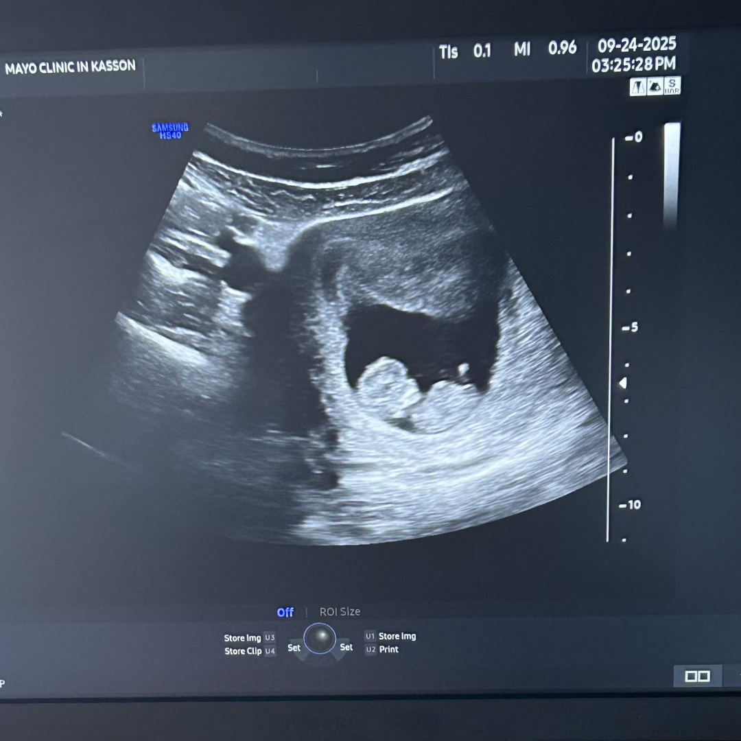 Photo shared by Ava for their Babylist baby registry.