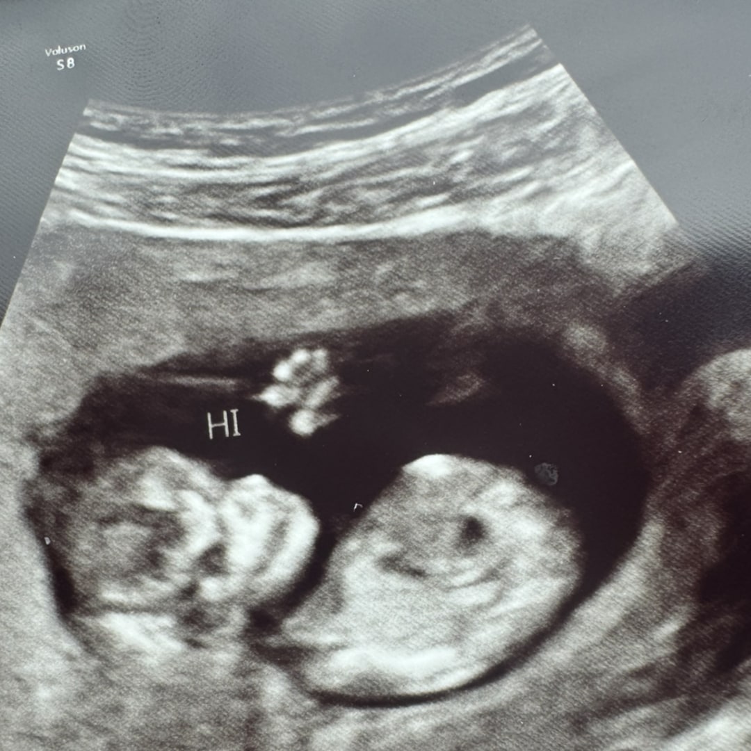 Photo shared by Katherine for their Babylist baby registry.